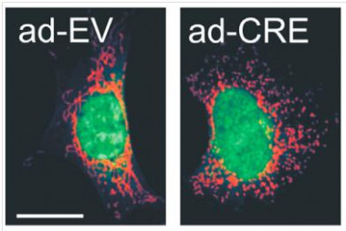 <p>La imagen refleja el cambio en la forma de las mitocondrias de fibroblastos de ratón. / CNIC</p>