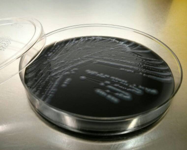 <p>Cultivo puro de un aislado clínico de <em>Legionella pneumophila</em></p>