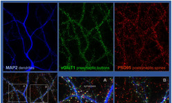 Detalle de neuronas de hipocampo crecidas durante 18 días, fijadas y procesadas para analizar sinapsis excitadoras.
